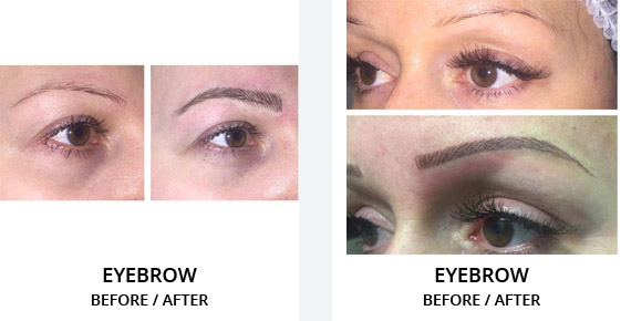 Eyebrow Before After