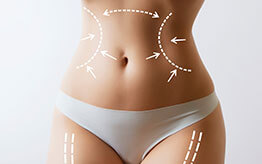 Liposuction Free Consultation